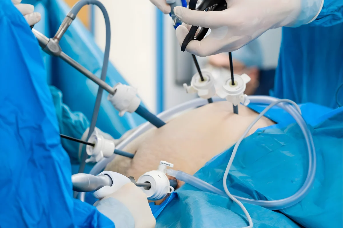 Laparoscopic and hysteroscopy Surgery